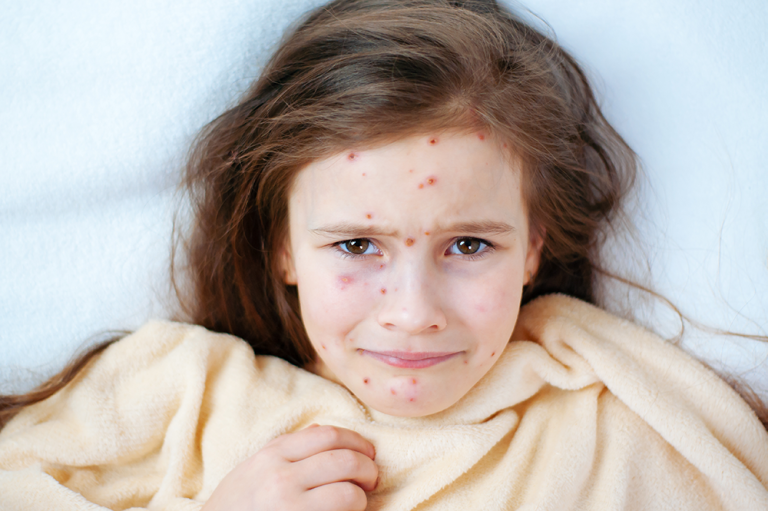 Simple Way To Identify If  Rash is Serious