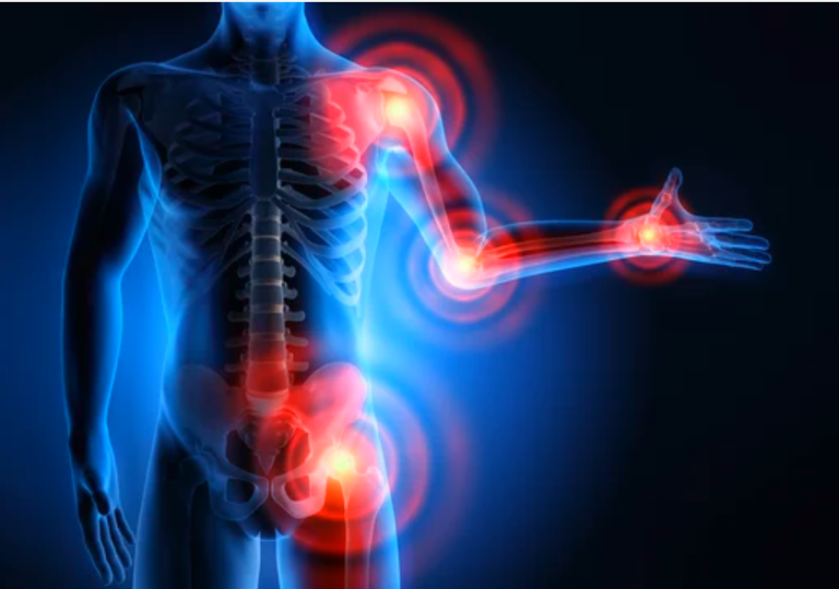 Things everyone should know when they are newly diagnosed with gout