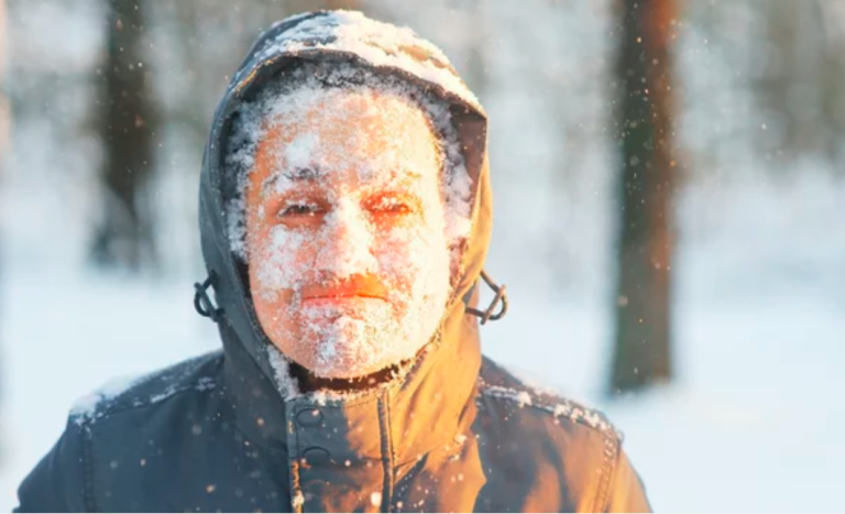 Seasonal Allergies