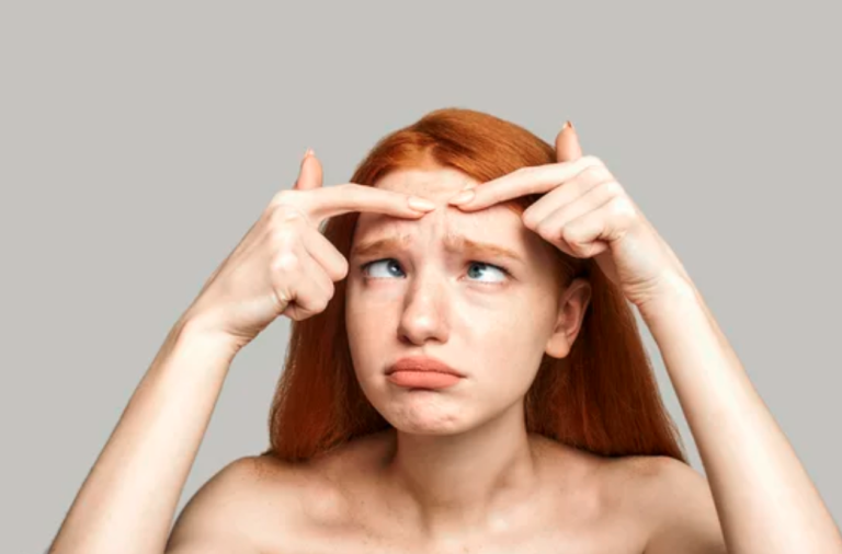 The benefits of seeing a medical provider for acne