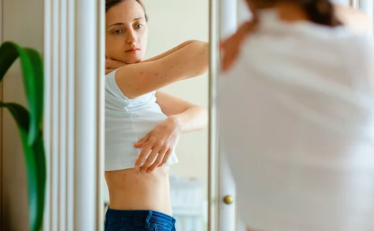 What are common rashes
