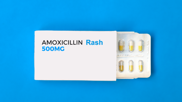 Amoxicillin Rash: Everything You Need To Know