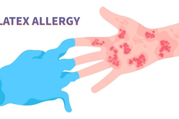 Latex Allergy
