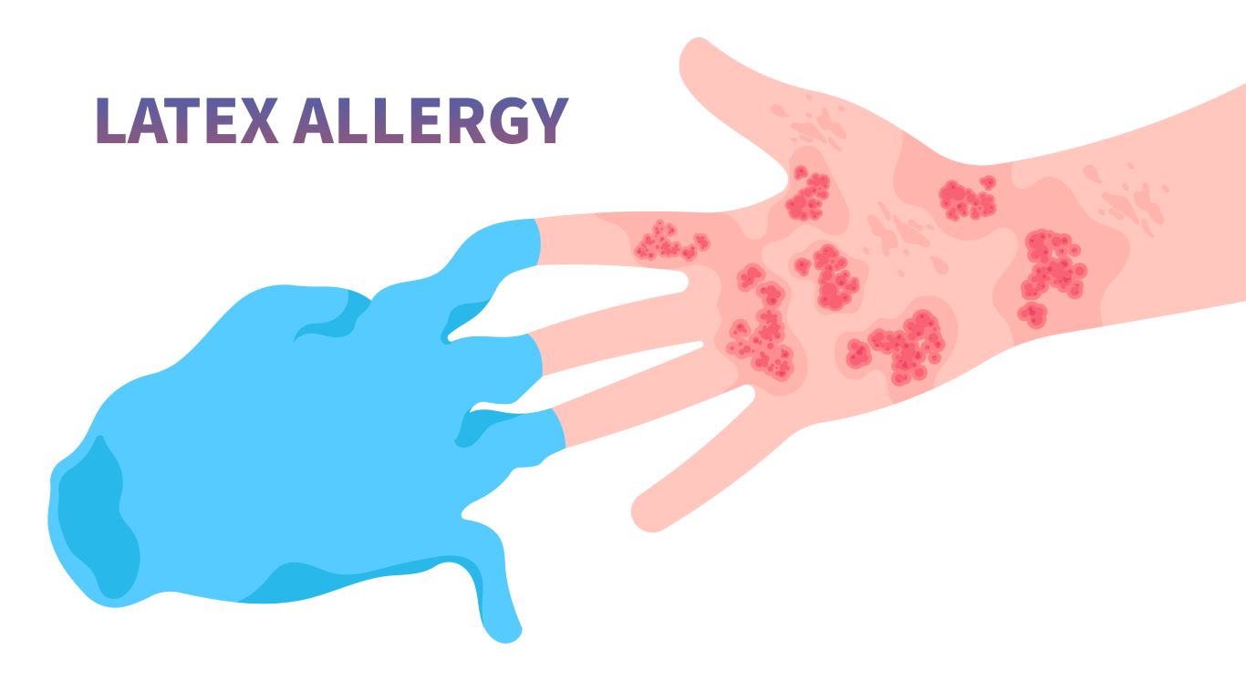 Latex Allergy