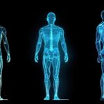 Whole Body MRI
